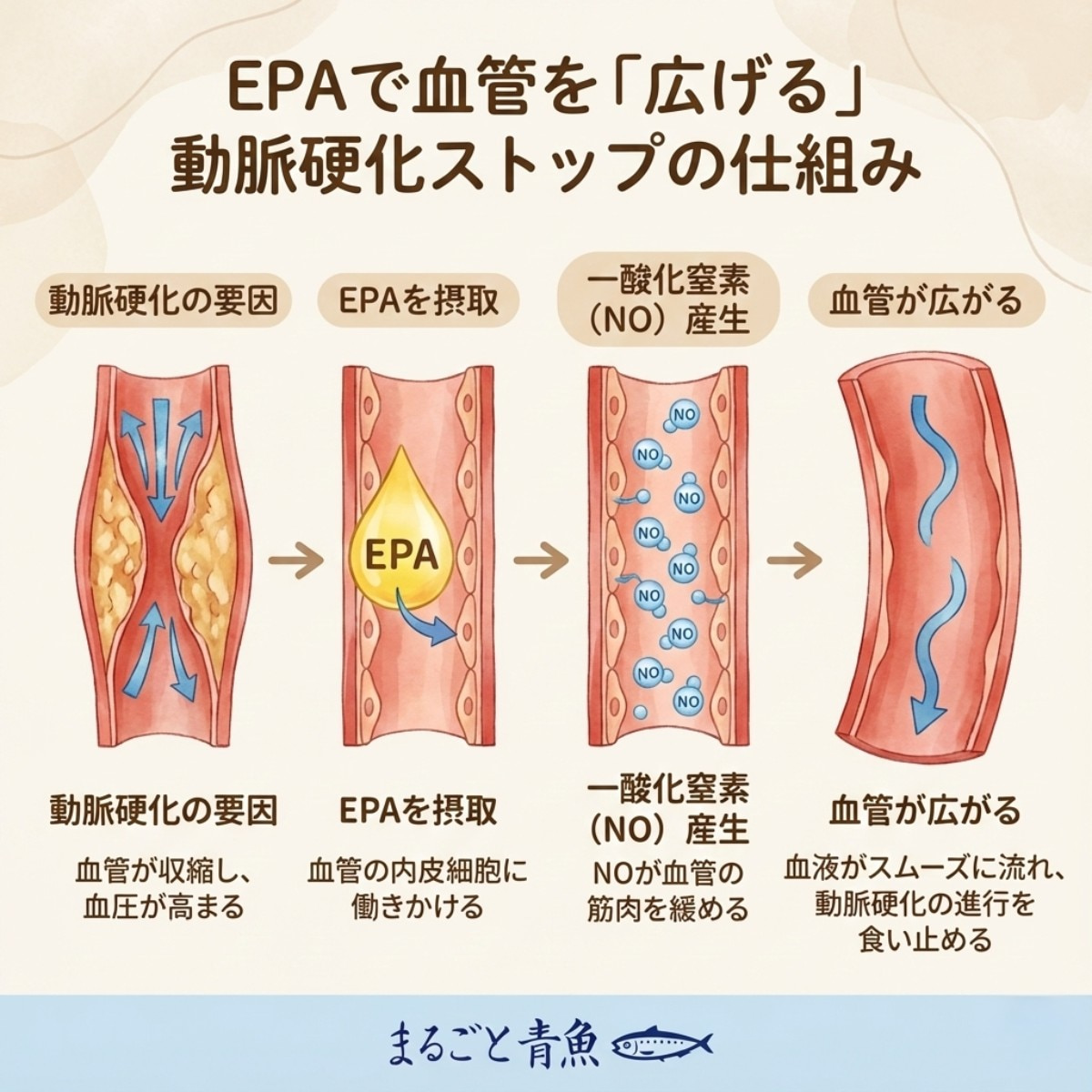 血管を「広げる」スイッチを入れる、EPAによる動脈硬化抑制の仕組み