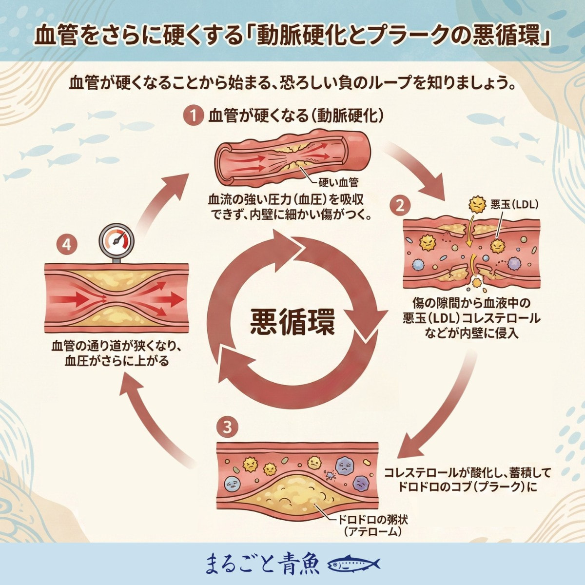 動脈硬化と血管プラークの悪循環
