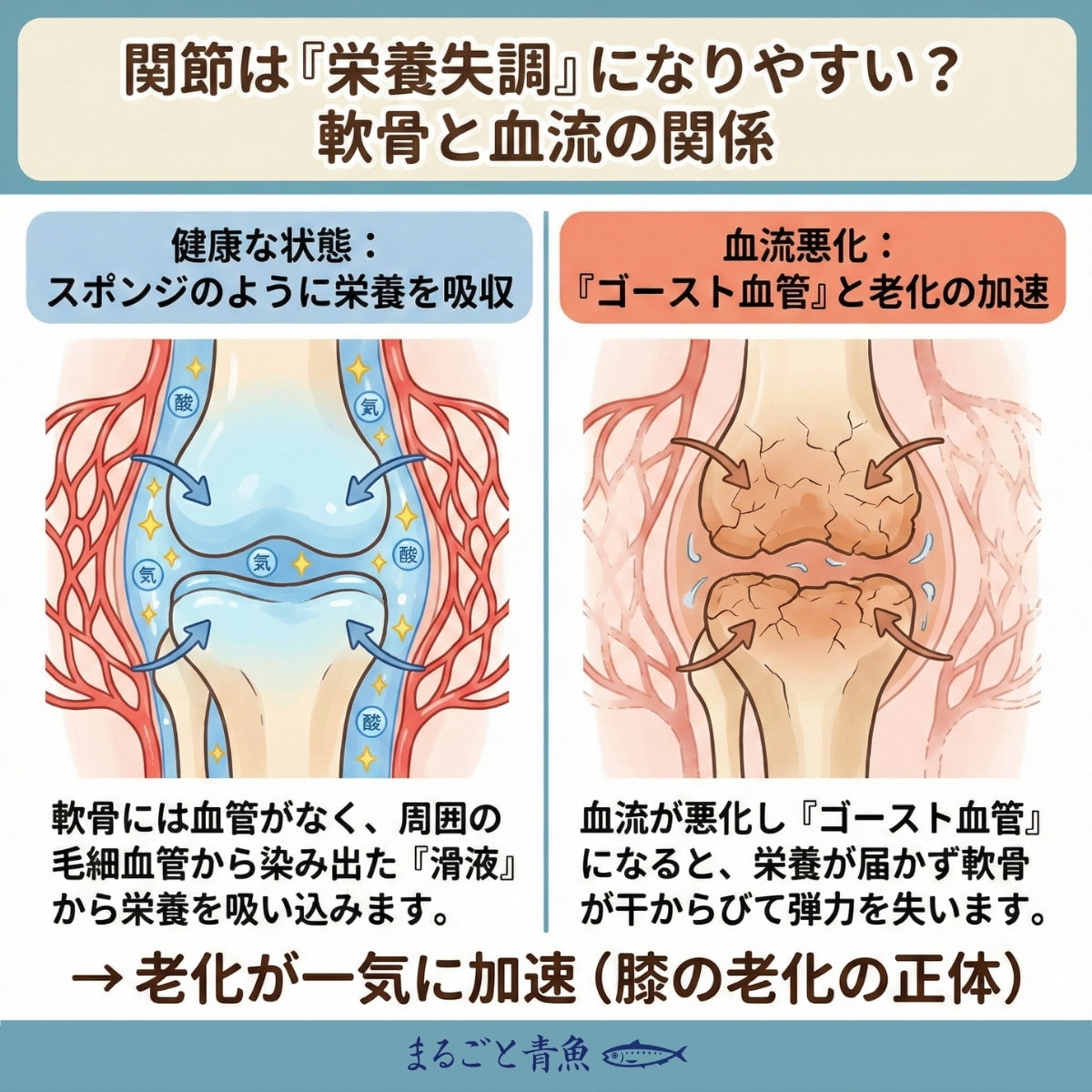 血流が悪くなると関節の栄養失調につながる